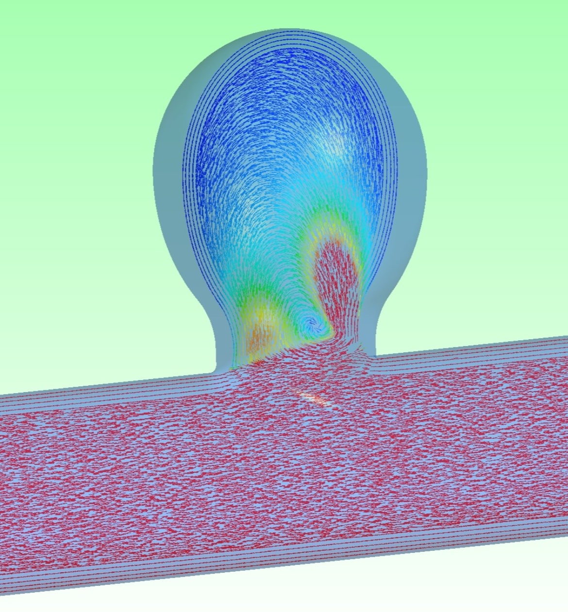 Numerical simulation of flow velocity vectors in an aneurysm model